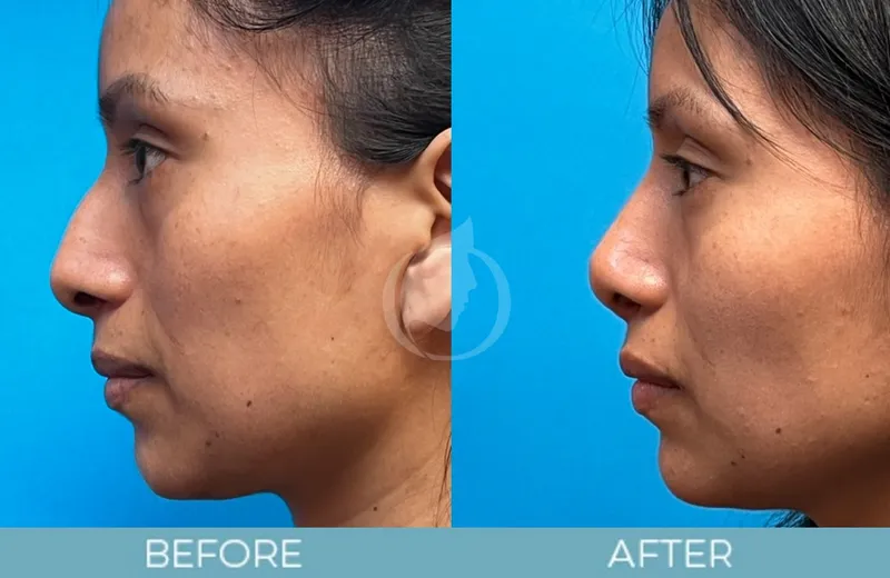Before and after — Dr. Aaron Fletcher