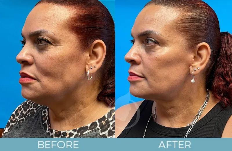 Before and after — Dr. Aaron Fletcher
