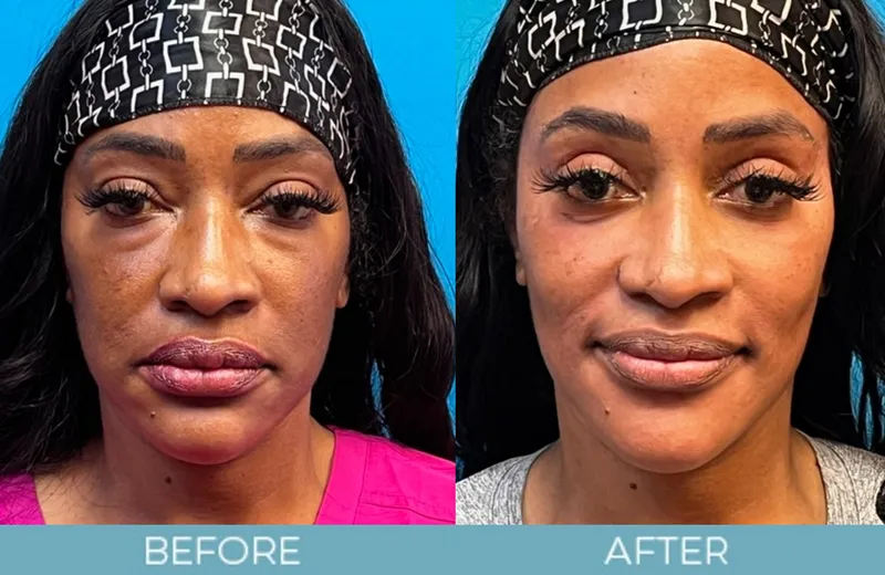 Before and after — Dr. Aaron Fletcher