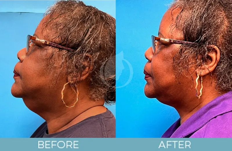 Before and after — Dr. Aaron Fletcher