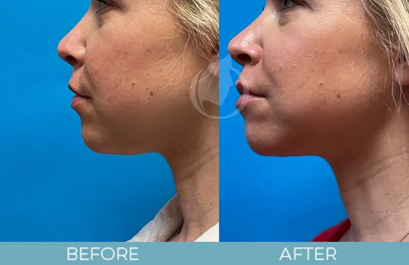 Before and after — Dr. Aaron Fletcher
