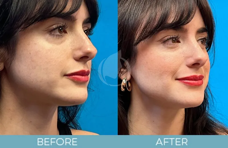 Before and after — Dr. Aaron Fletcher