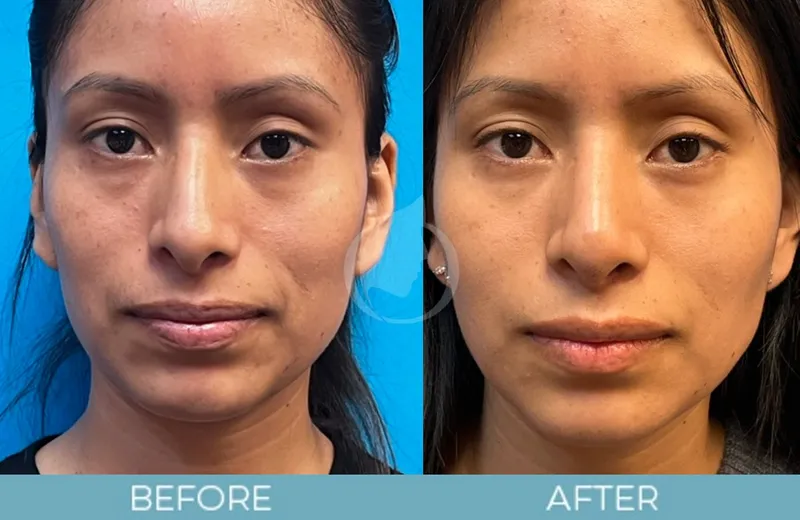 Before and after — Dr. Aaron Fletcher