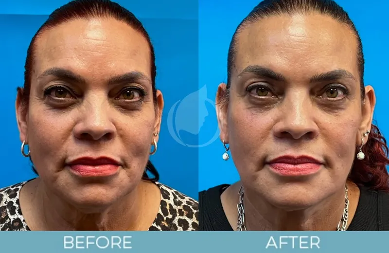 Before and after — Dr. Aaron Fletcher