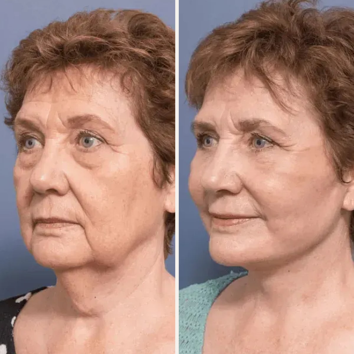 Before and after: Dr. Adam Honeybrook