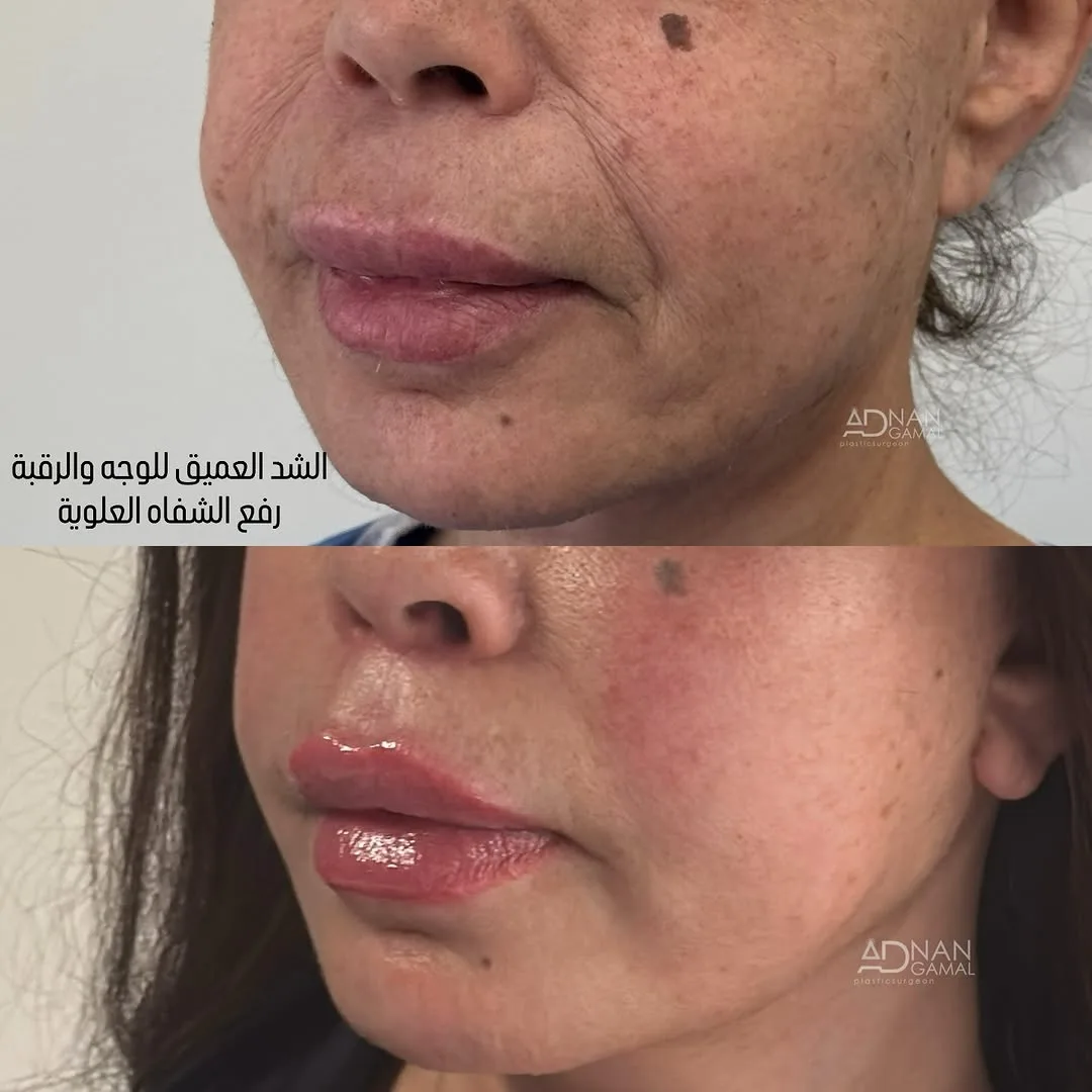 Before and after — Dr. Adnan Gamal