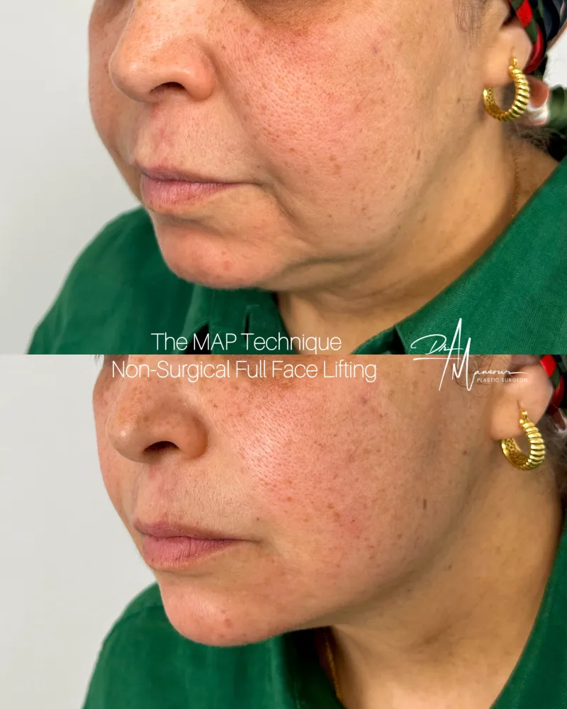 Before and after: Dr. Ahmed Mansour