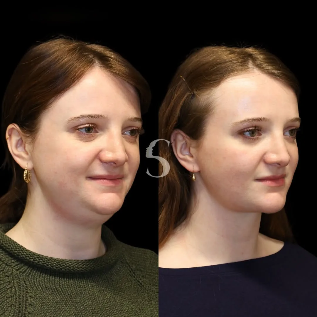 Before and after — Dr. Akshay Sanan