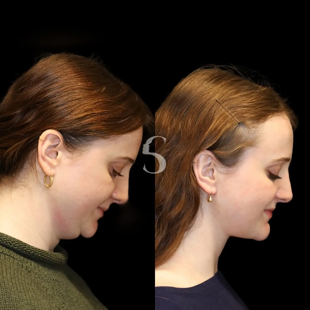 Before and after — Dr. Akshay Sanan