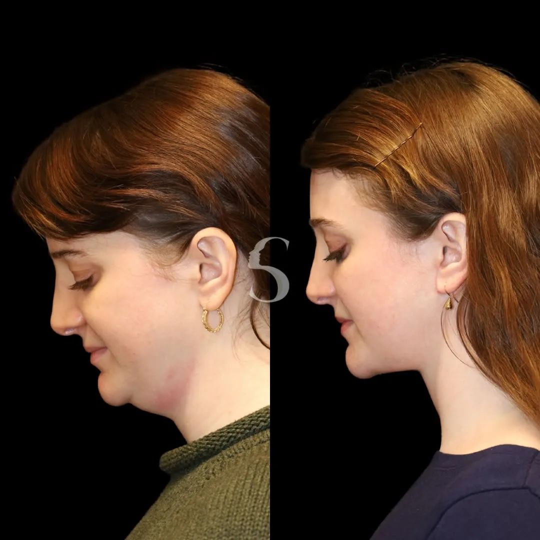 Before and after — Dr. Akshay Sanan