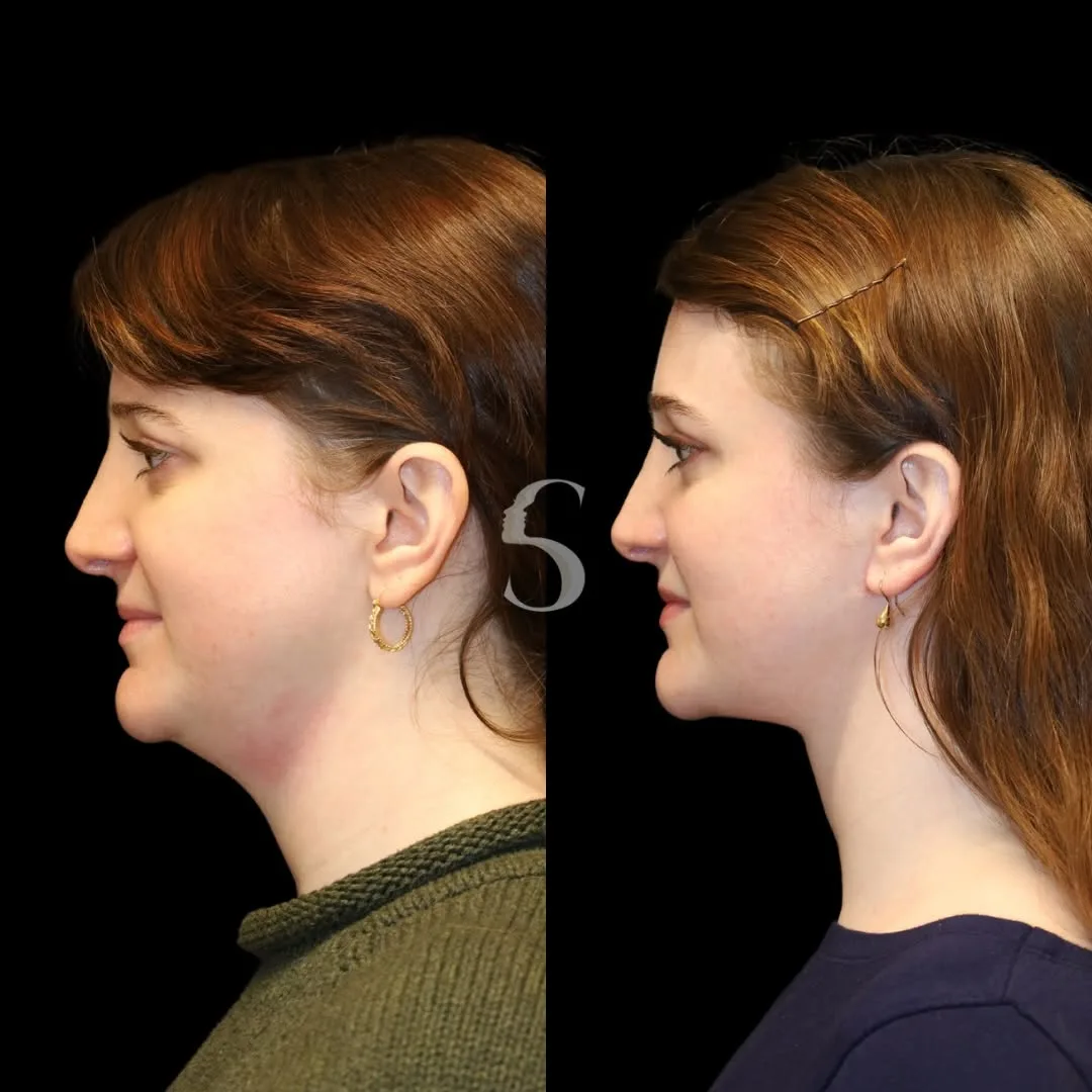Before and after — Dr. Akshay Sanan