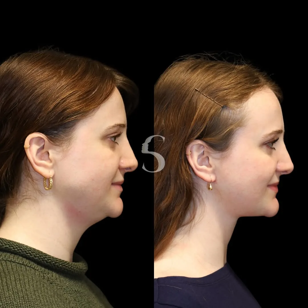 Before and after — Dr. Akshay Sanan