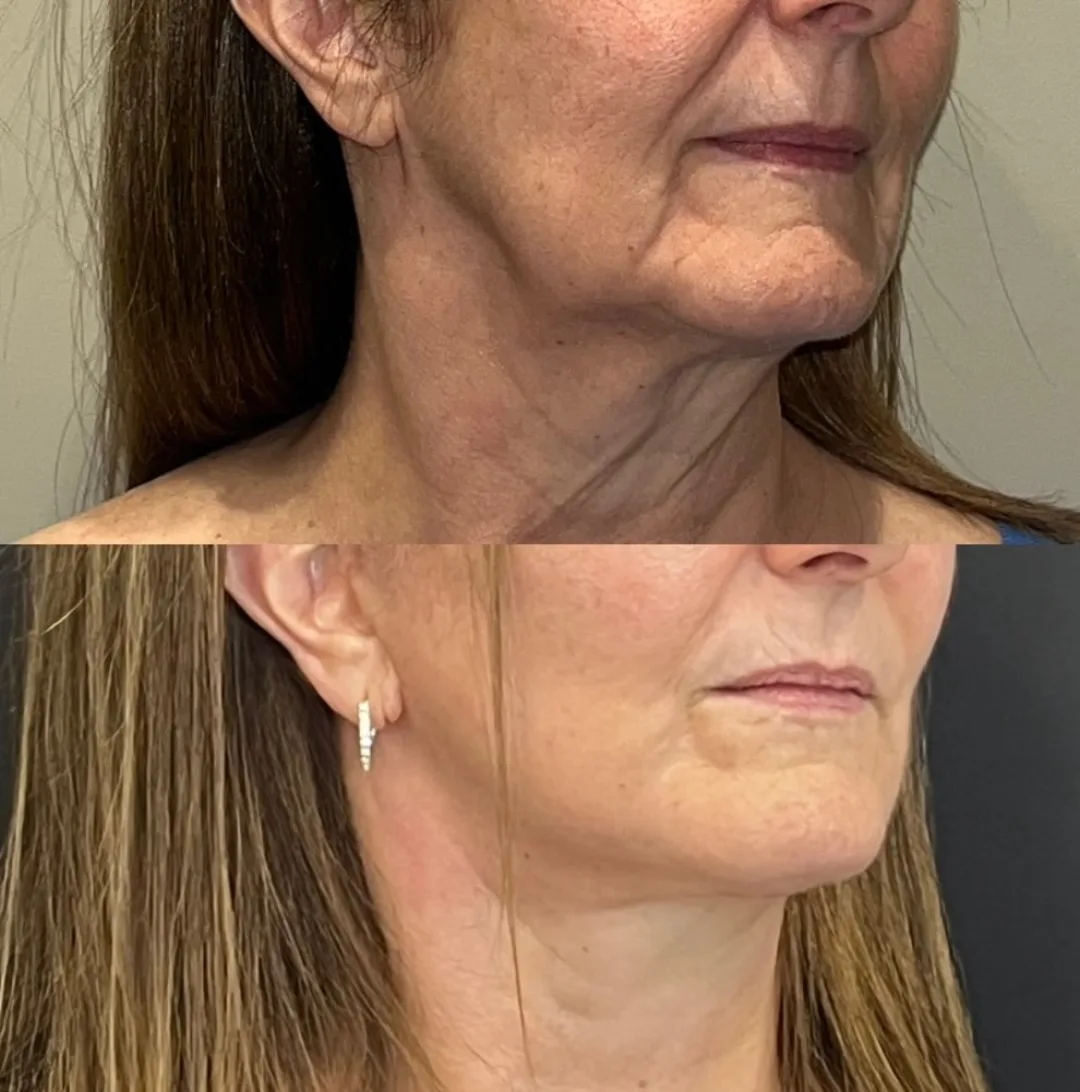 Before and after — Dr. Alejandro Conejero