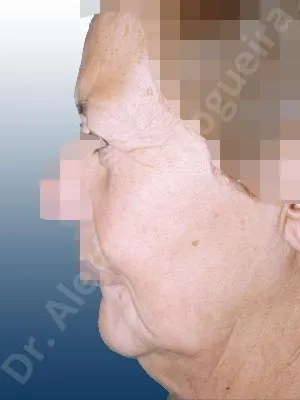 Before and after — Dr. Alejandro Nogueira
