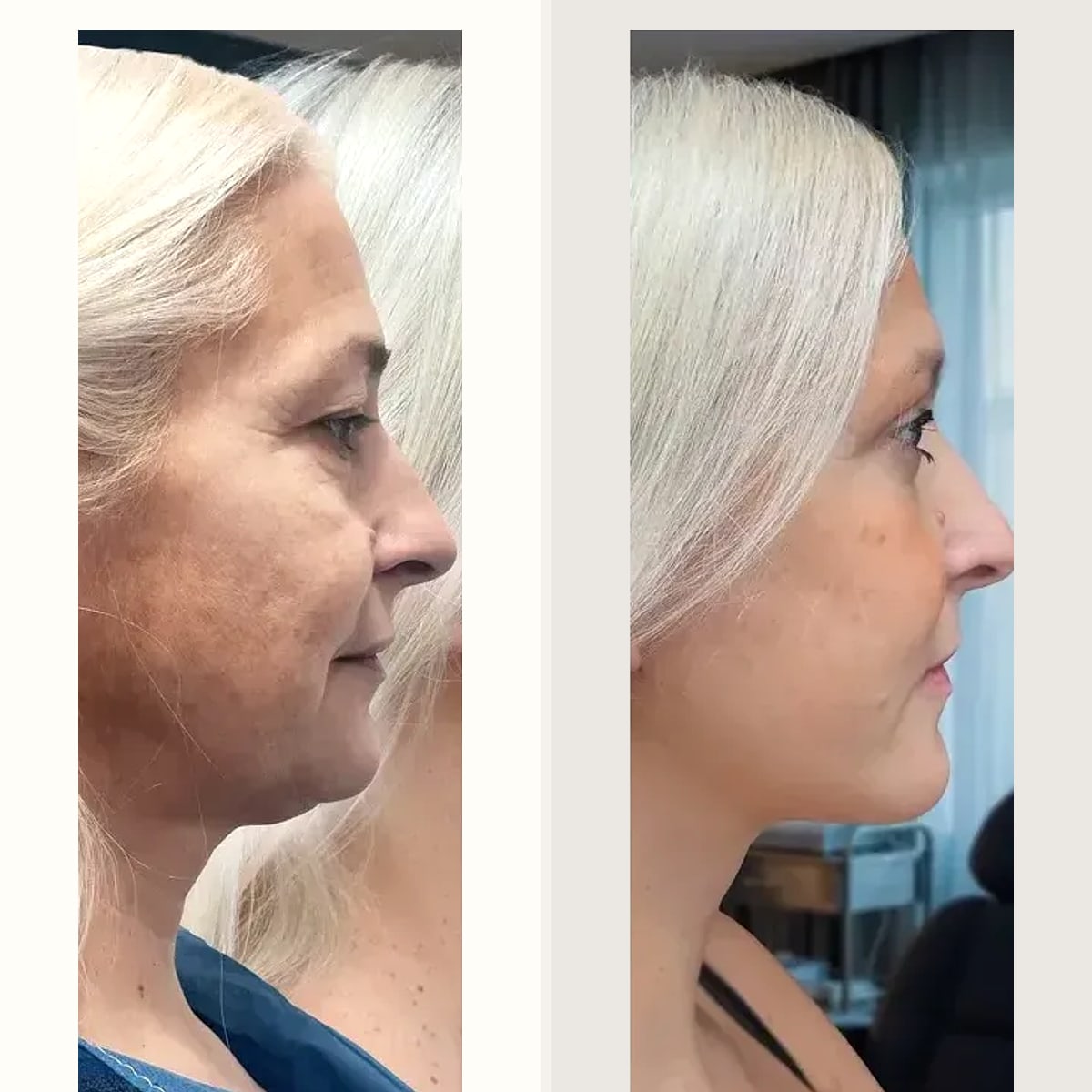 Before and after: Dr. Alessandro Gualdi