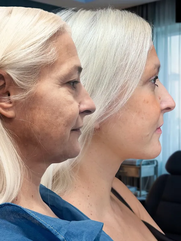 Before and after — Dr. Alessandro Gualdi