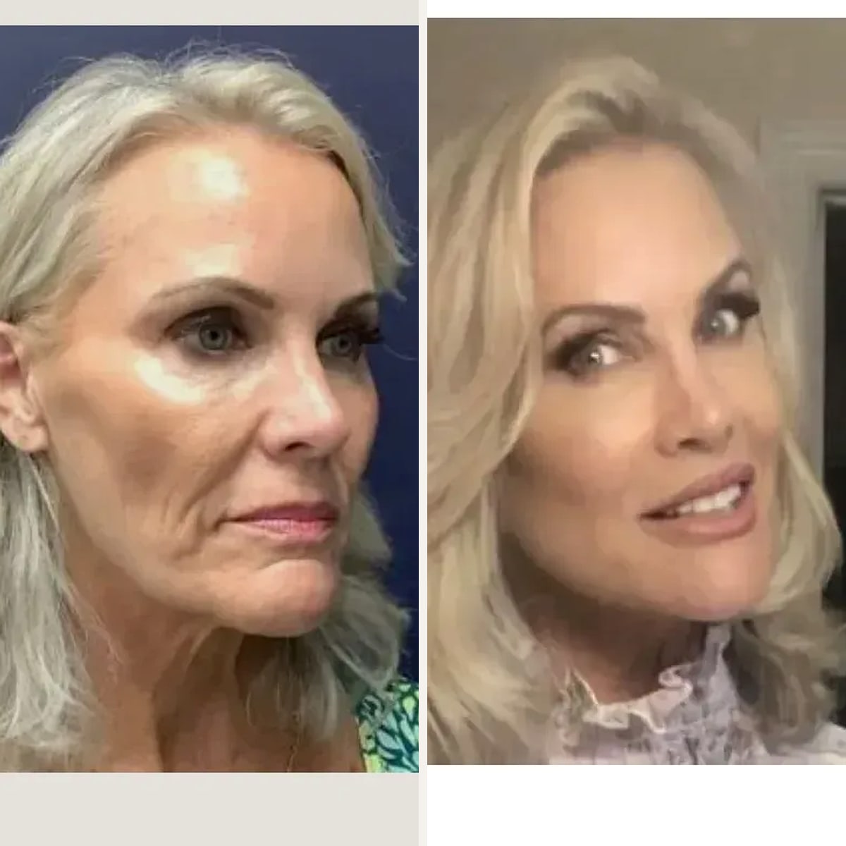 Before and after: Dr. Alex Campbell