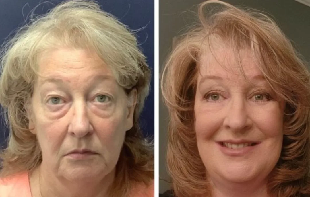 Before and after: Dr. Alex Campbell