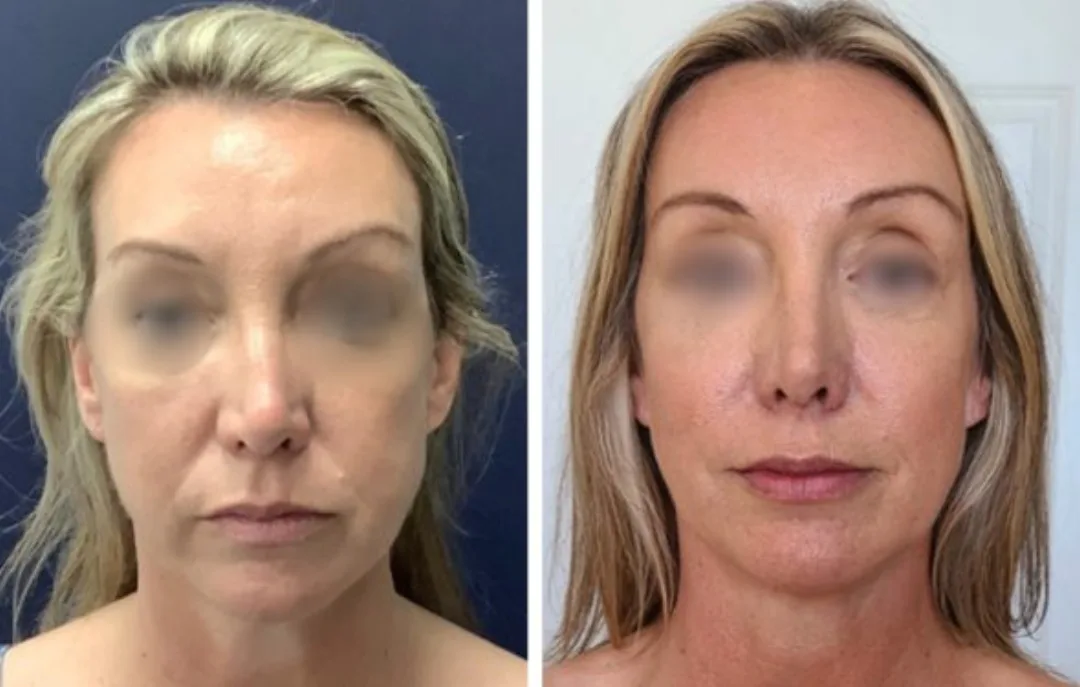Before and after: Dr. Alex Campbell