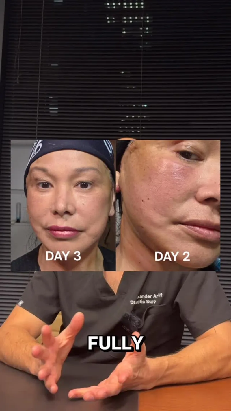 Before and after: Dr. Alexander Anzarut