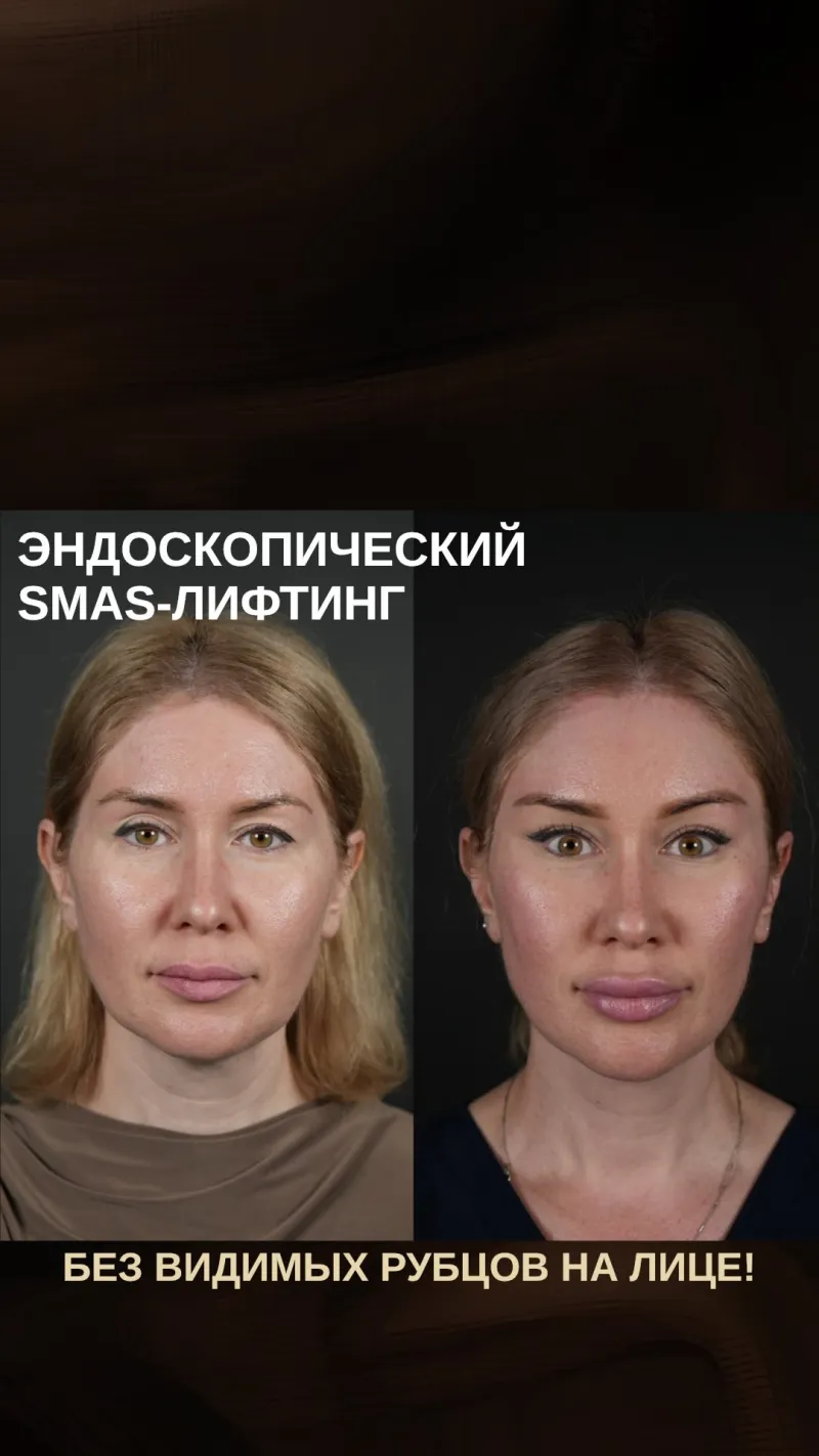Before and after: Dr. Alexander Sokolov
