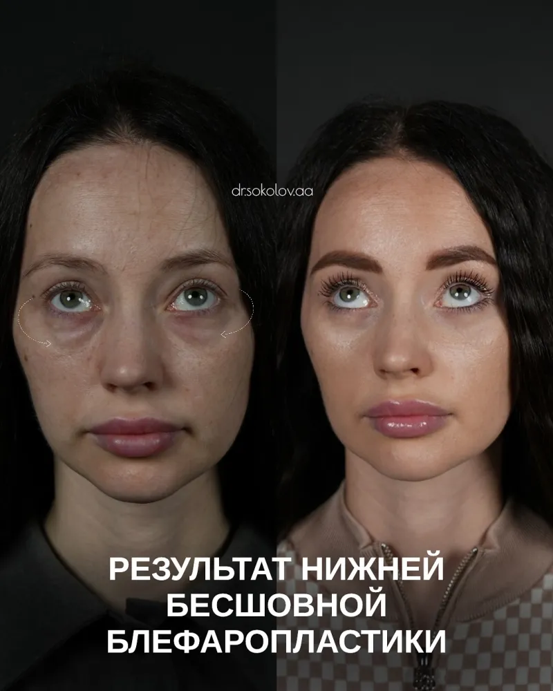 Before and after: Dr. Alexander Sokolov
