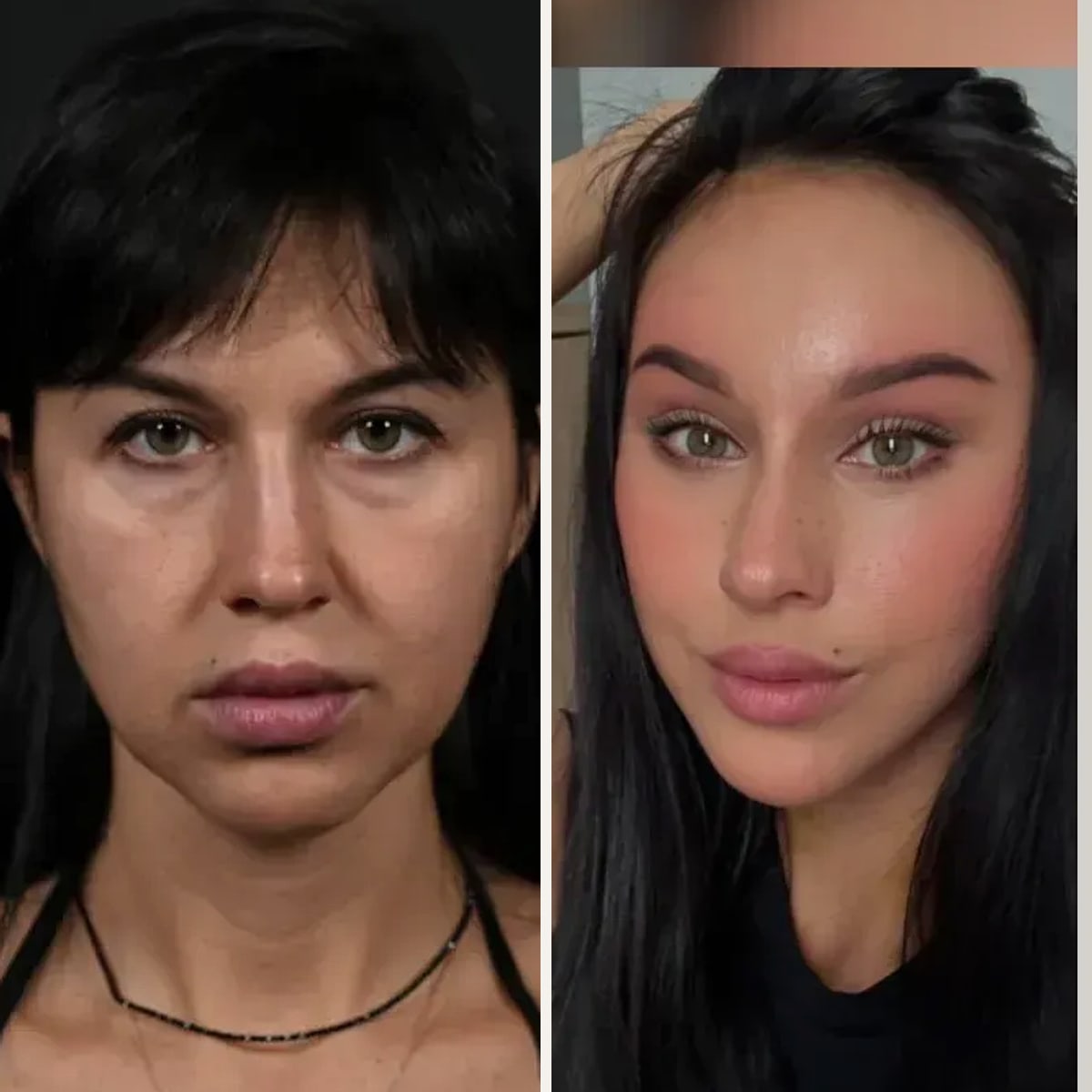 Before and after: Dr. Alexander Sokolov