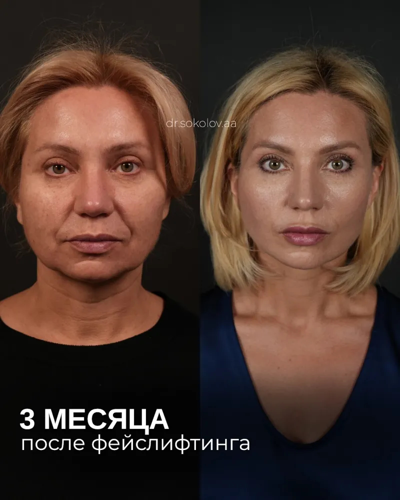 Before and after: Dr. Alexander Sokolov