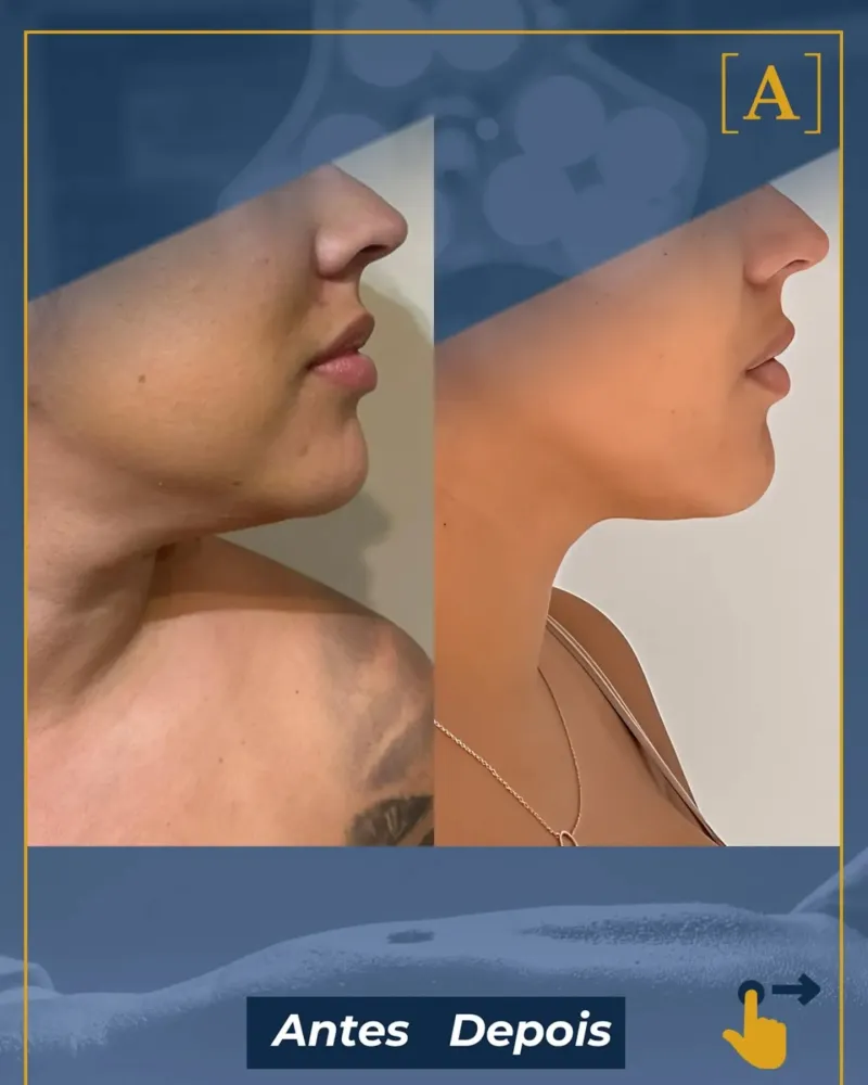 Before and after: Dr. Alexandre Charão