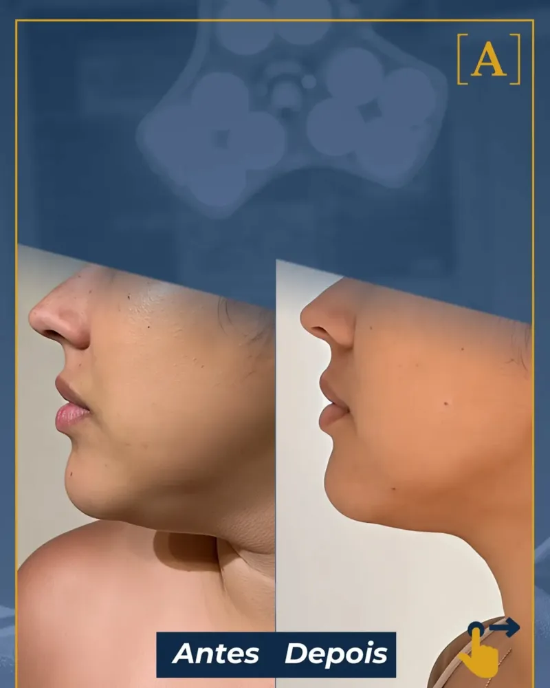Before and after: Dr. Alexandre Charão
