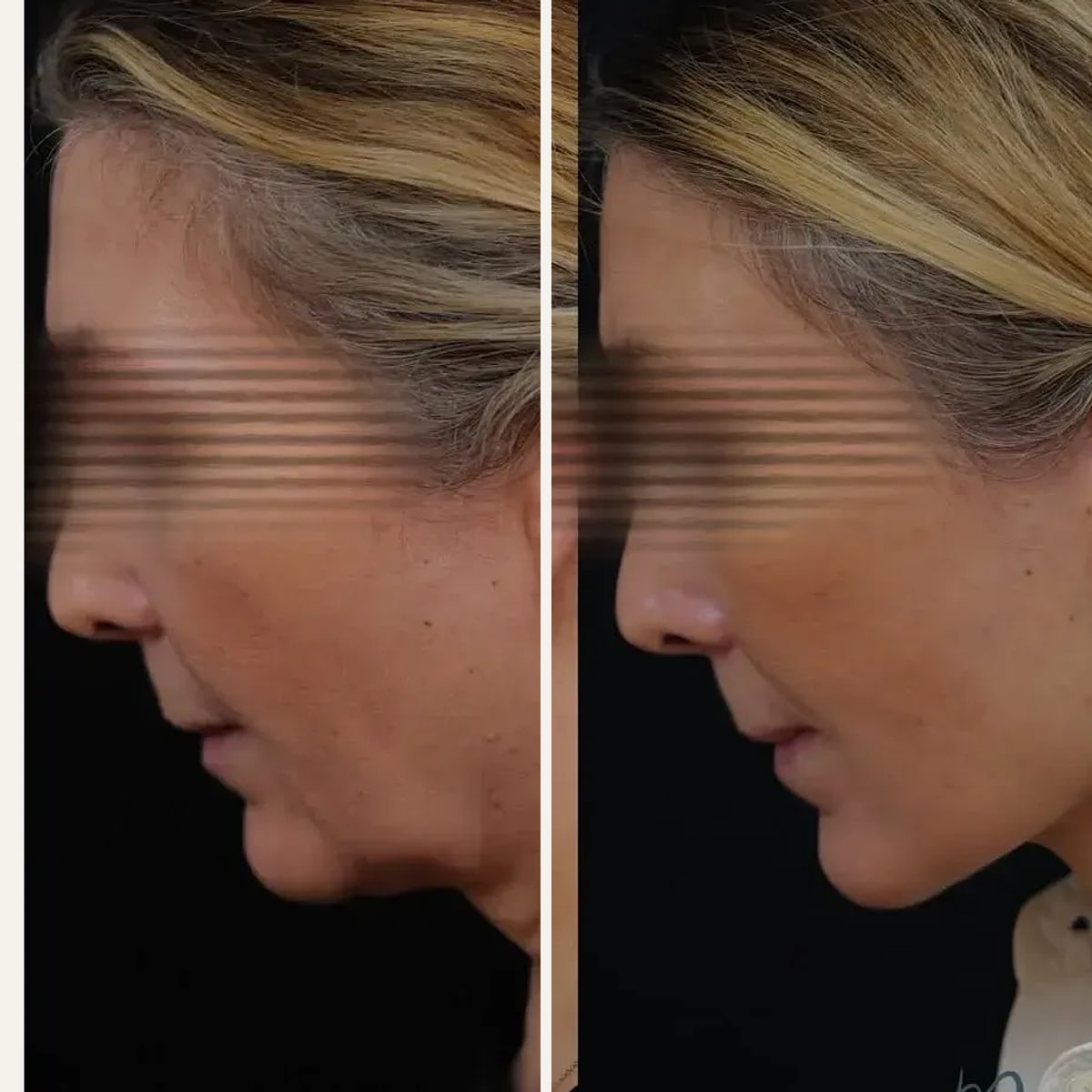 Before and after: Dr. Alexandre Marchac