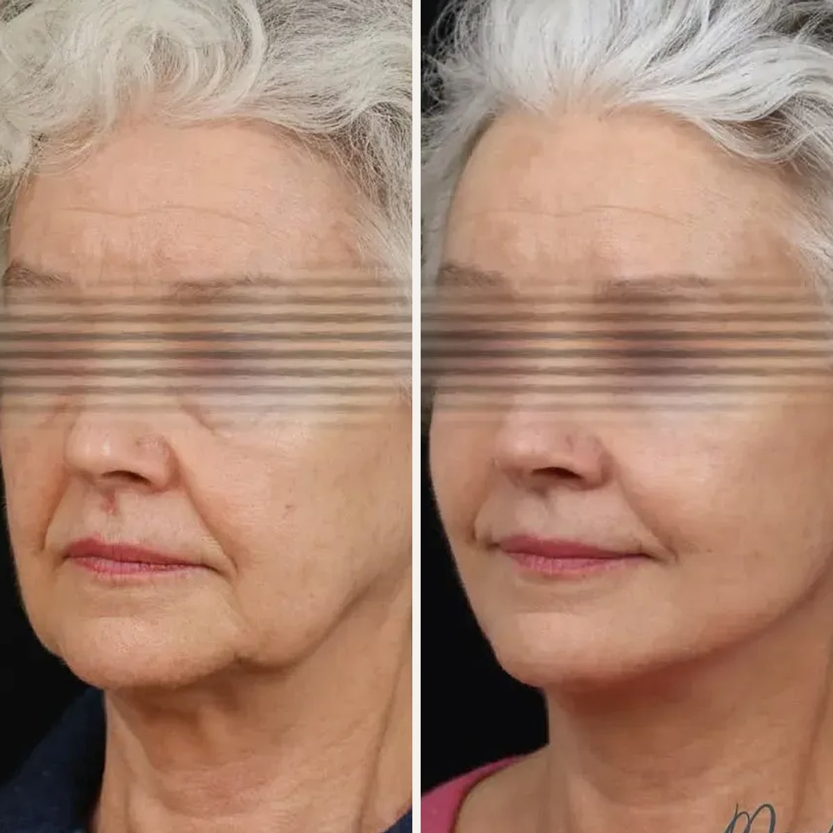 Before and after: Dr. Alexandre Marchac