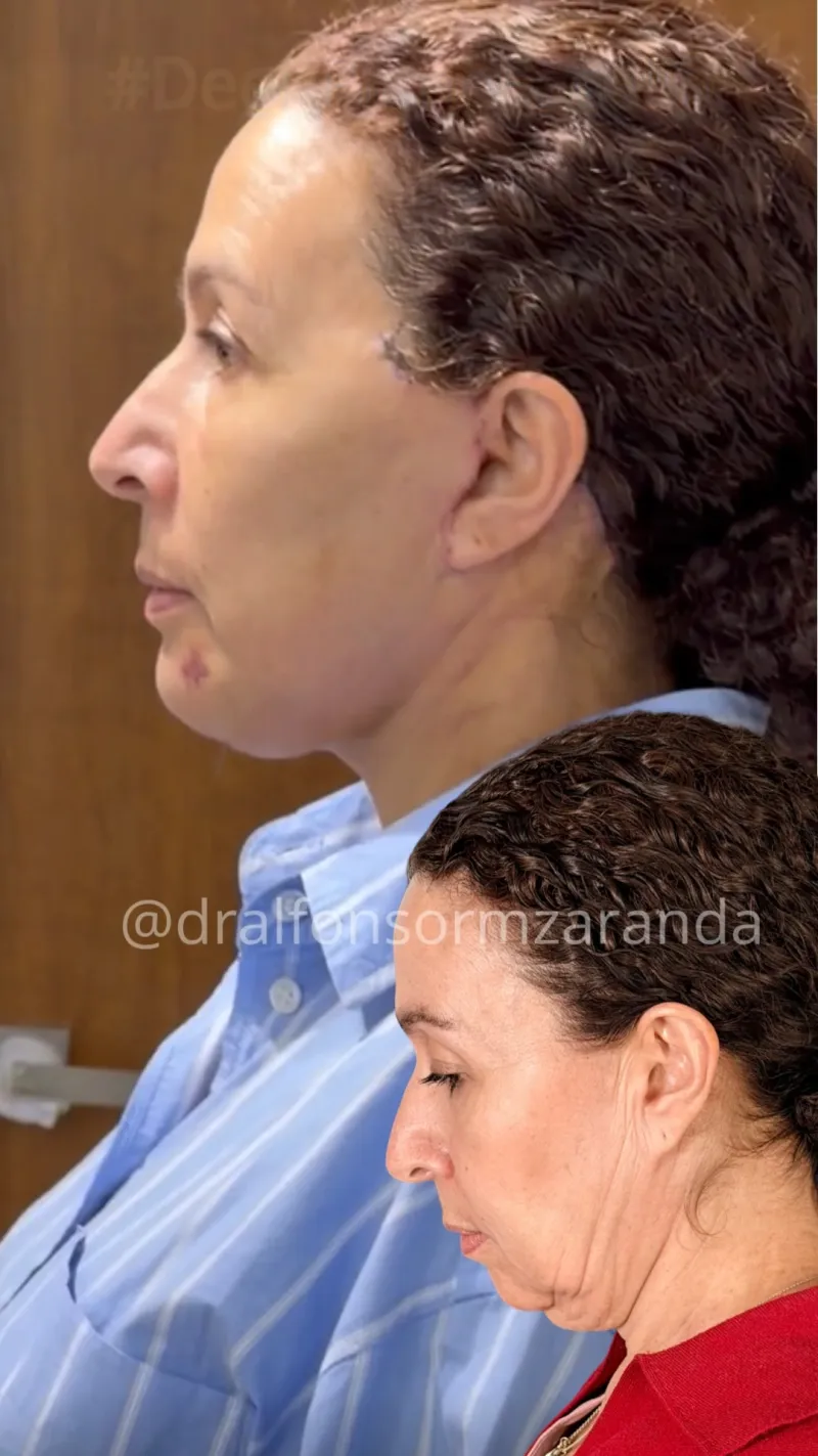 Before and after: Dr. Alfonso Ramírez Aranda