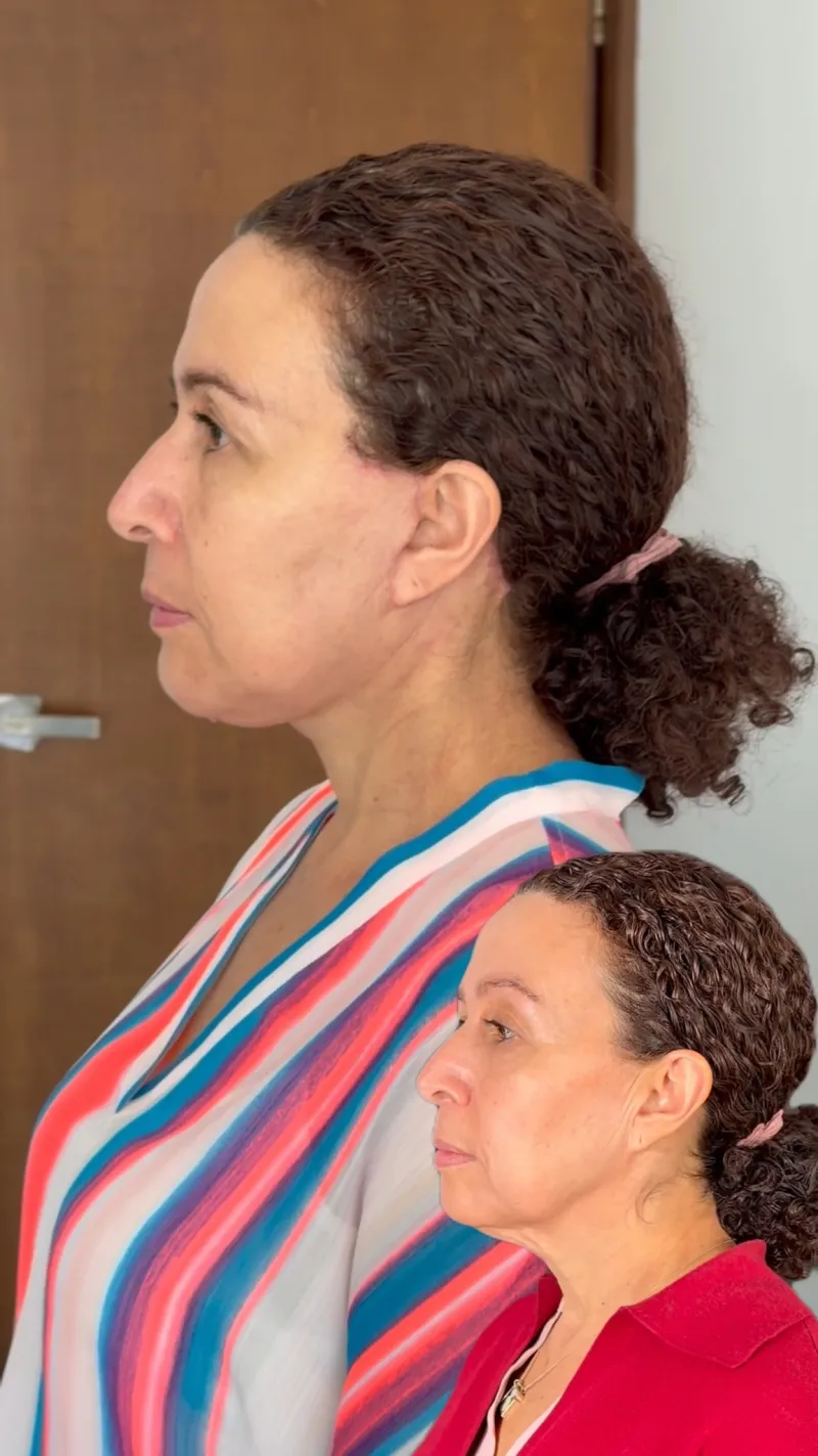 Before and after: Dr. Alfonso Ramírez Aranda