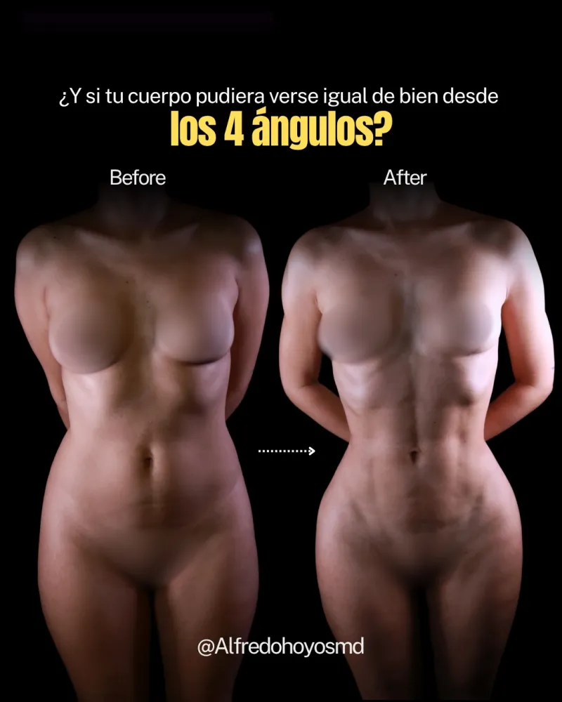 Before and after — Dr. Alfredo Hoyos