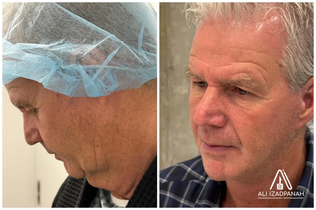 Before and after: Dr. Ali Izadpanah