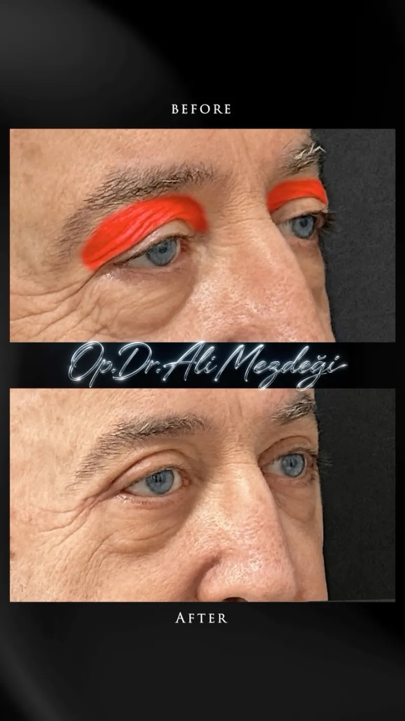 Before and after: Dr. Ali Mezdegi