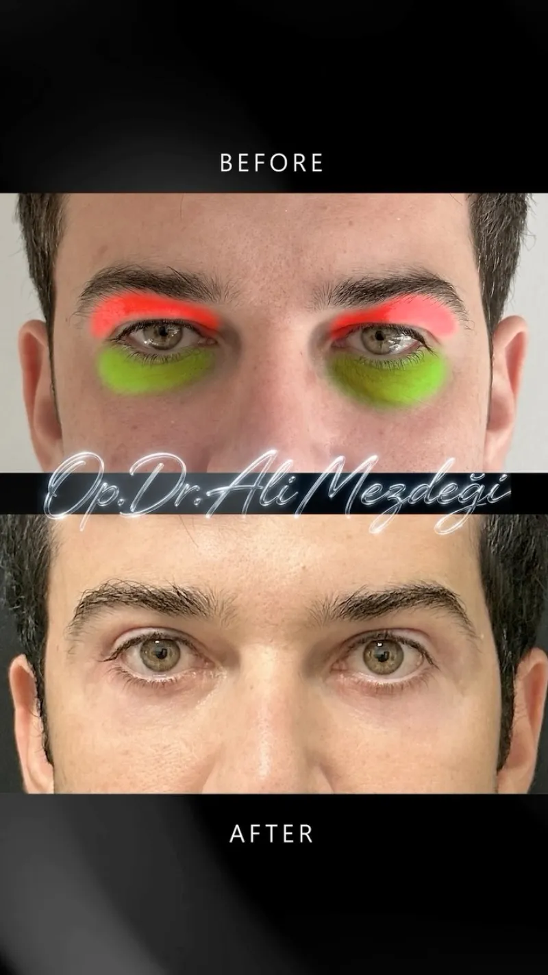 Before and after: Dr. Ali Mezdegi