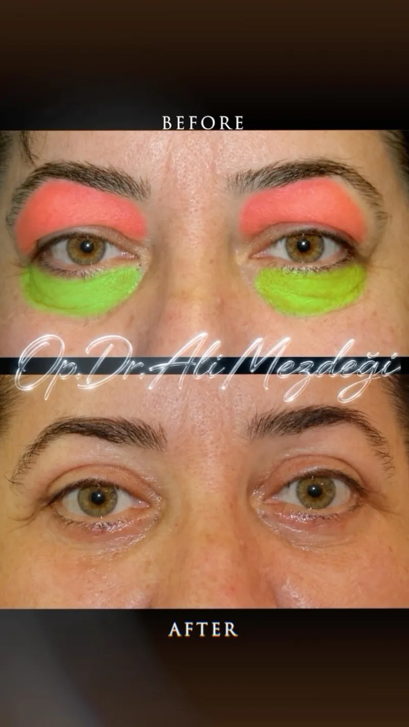 Before and after: Dr. Ali Mezdegi