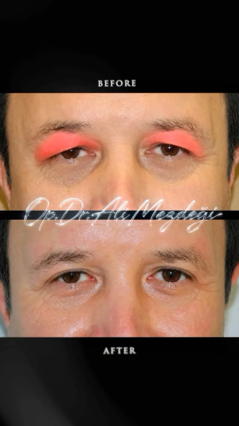 Before and after: Dr. Ali Mezdegi