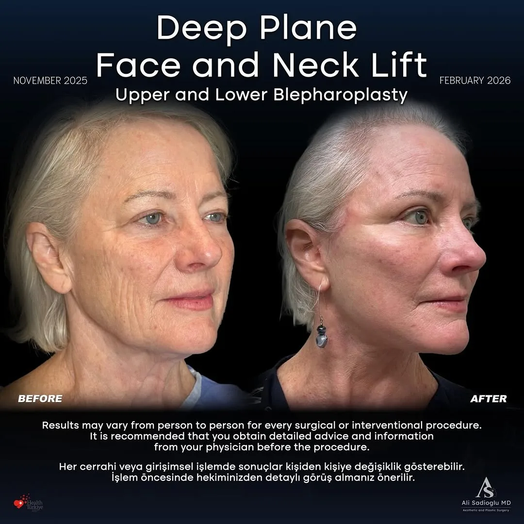 Before and after — Dr. Ali Sadıoğlu