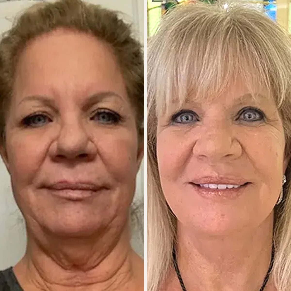 Before and after: Dr. Allen Foulad