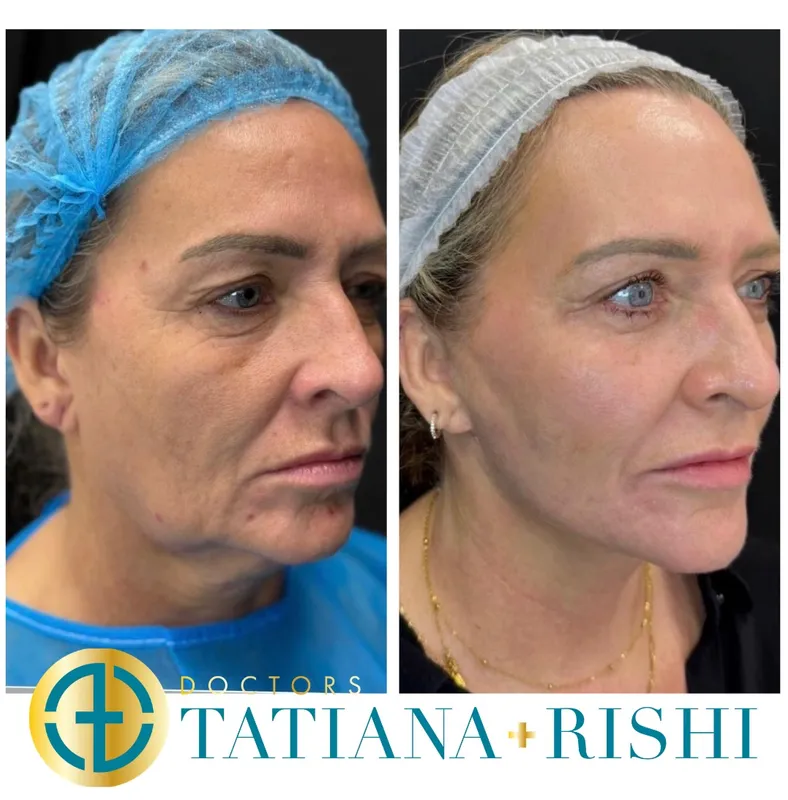 Before and after — Prof. Alwyn D'Souza