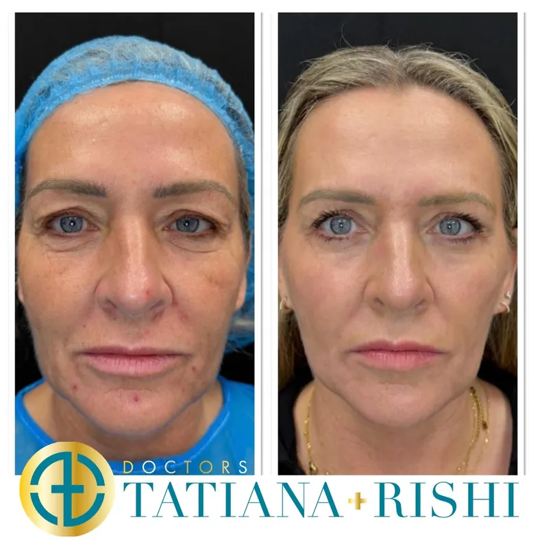 Before and after — Prof. Alwyn D'Souza