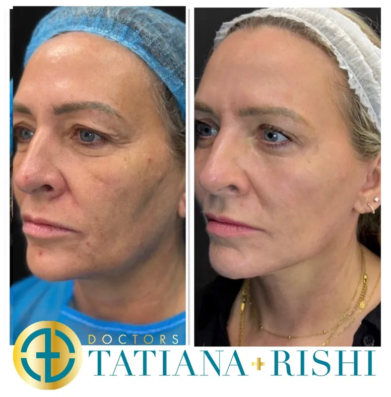 Before and after — Prof. Alwyn D'Souza