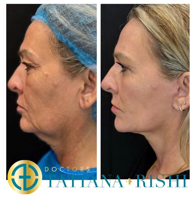 Before and after — Prof. Alwyn D'Souza