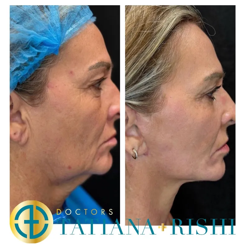 Before and after — Prof. Alwyn D'Souza