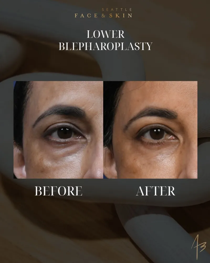 Before and after: Dr. Amit Bhrany