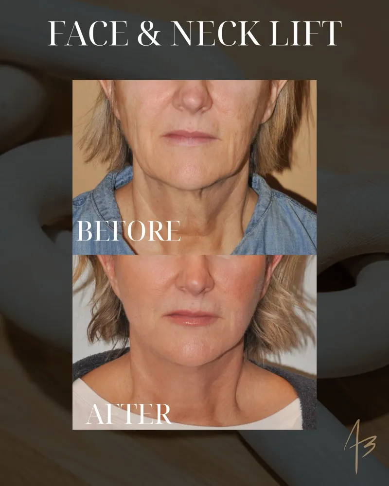 Before and after: Dr. Amit Bhrany