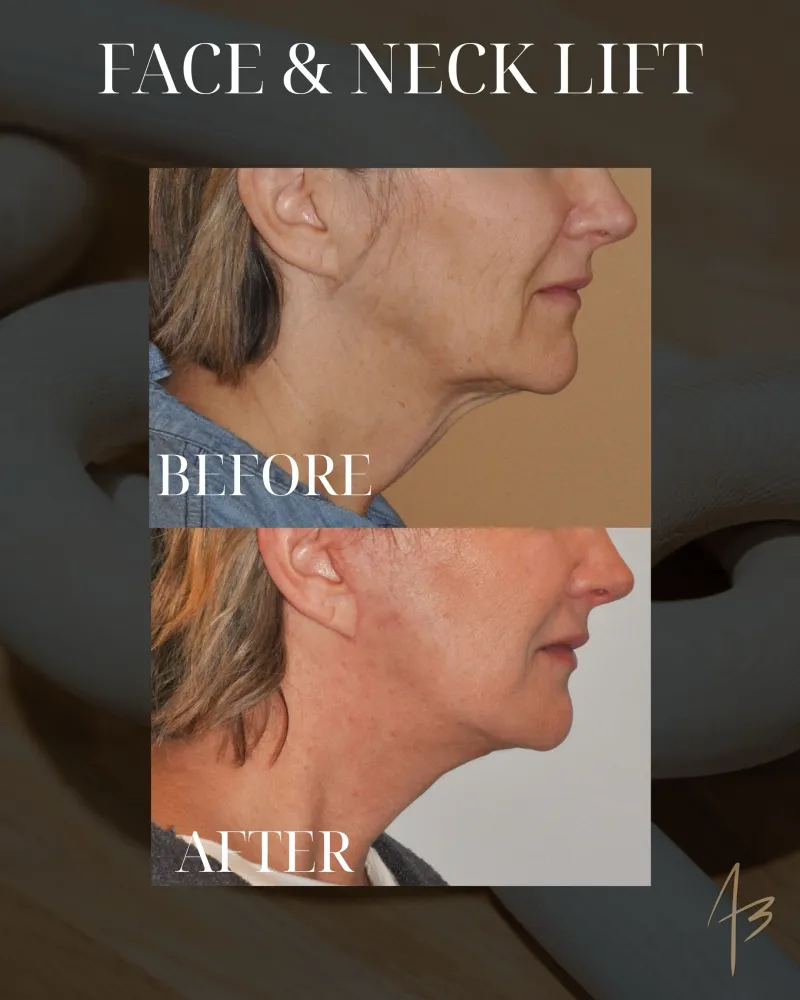 Before and after: Dr. Amit Bhrany